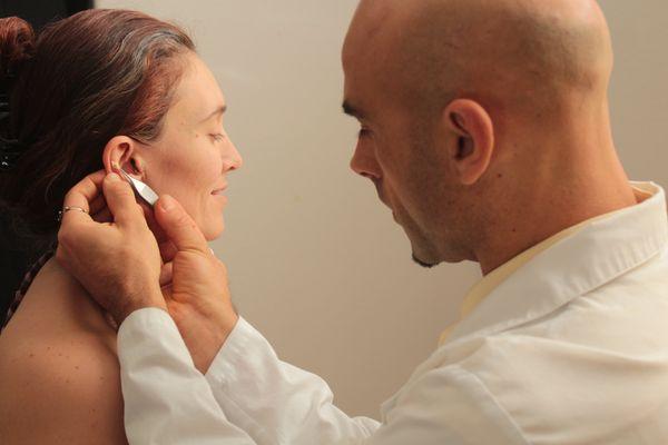 Ear acupuncture involves inserting needles into specific points on the ear to bring healing.