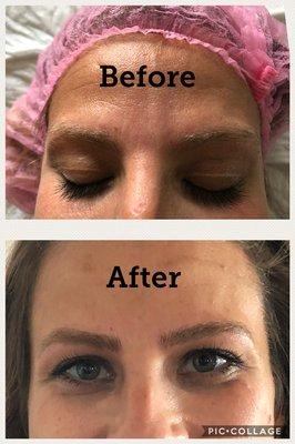 Microblading