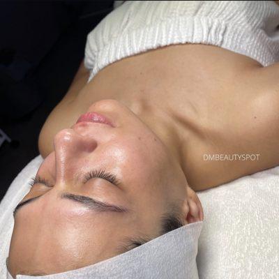 Dermaplane facial glow