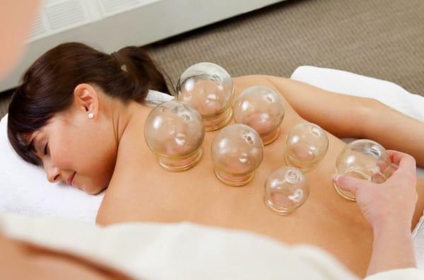 Cupping Treatment