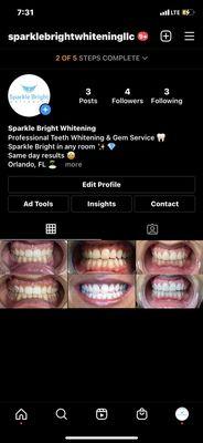 Follow our following @sparklebrightwhiteningllc