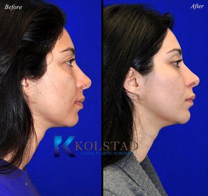 Kolstad Facial Plastic Surgery