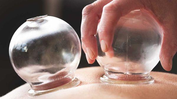 Cupping is also called myofascial decompression, as it creates a negative pressure on the muscles and connective tissues