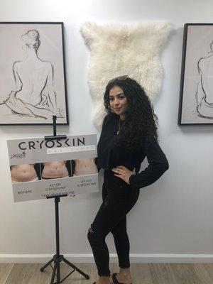 Cryoskin- Want to loose inches on your abdomen!
Cryoskin is for you!
Client Testimonial. Real Results!
Leave messages- -- 1-866-463-3477