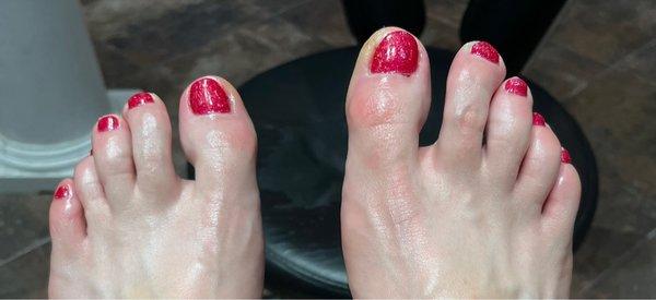 Gel pedicure, callus removal