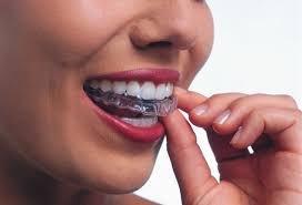 Invisalign invisible braces