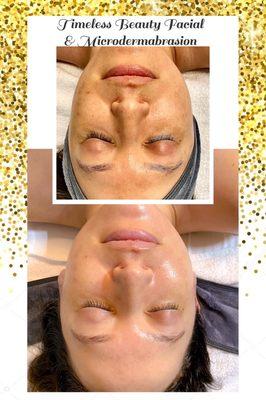 Timeless Beauty Facial