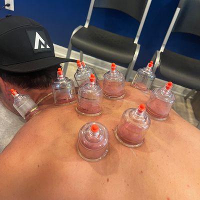 Are you looking for a natural way to alleviate pain and enhance your well-being? Discover the benefits of cupping therapy at ...