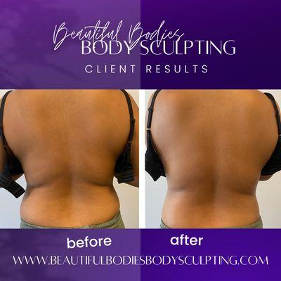 Beautiful Bodies Body Sculpting