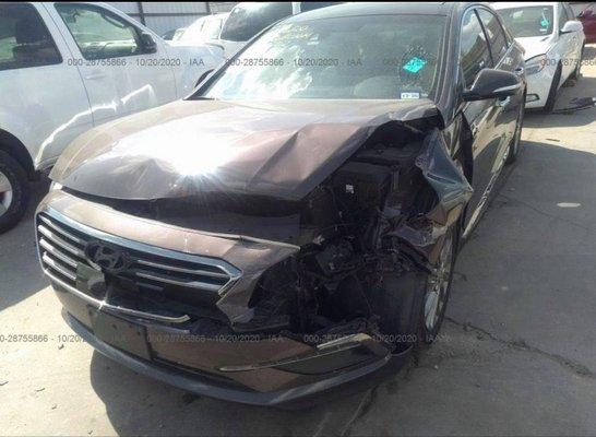 2015 Hyundai Sonata Before Repair