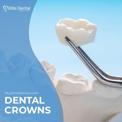 A crown covers a damaged tooth like a cap, making it look perfect. For more information about this and other procedures, contact us.