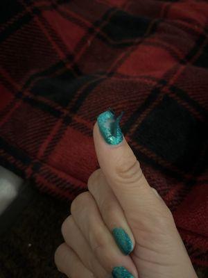 My nail got "fixed" today and it came right back up