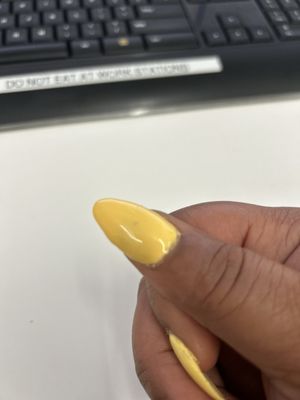 Over sized thumb nail with uneven and bumpy acrylic, horrible polish