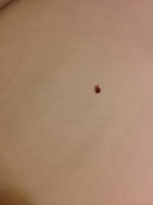 Fuzzy, but little red bedbugs.