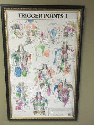 Trigger Points in Acupuncture, with relevance to the Voice, Otolaryngology (ENT), and holistic performance care.