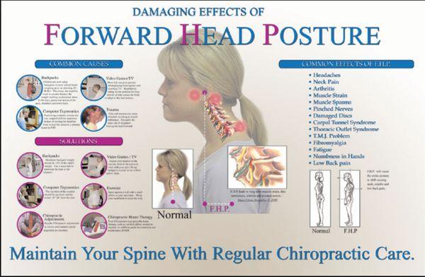 Our Office Specializes in Correction of Forward Head Posture!