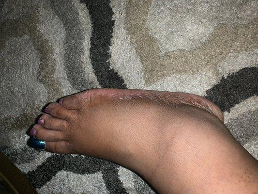 My foot once I came home from the salon