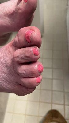 Sloppy nail polish (right foot)