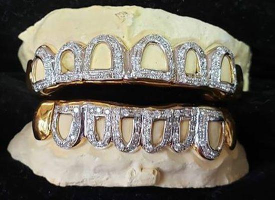 Gold open face diamond Grillz upper and lower