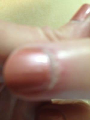 Hard to see but this is one day after my mom got her nails done. All red and infected. Gross.