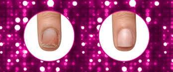 Restore peeling, brittle nails that are recovering from acrylic use or regular
gel application.