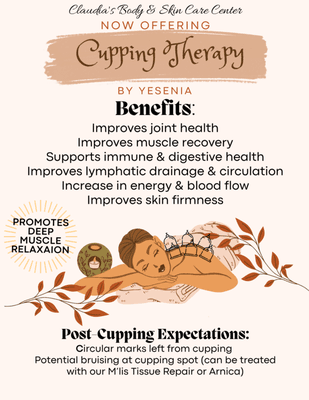 We offer cupping therapy in addition to our regular massage offerings! Cupping can be done as a separate session or add-on to a massage!