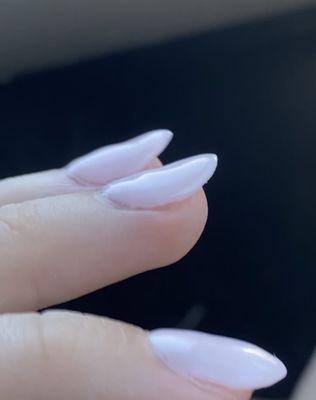 Thin and lifted upwards nails