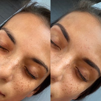 Microblading