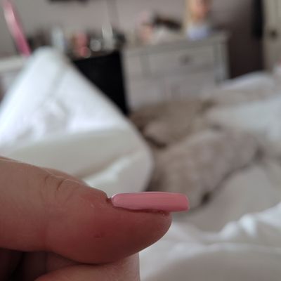 Flat nail, no natural bump. Awful.