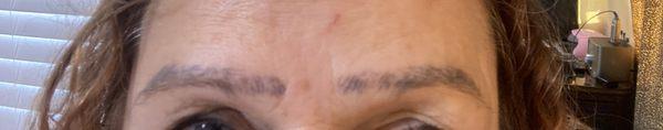 Eyebrows Tattoo Removal