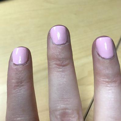 Cuticle finally healing