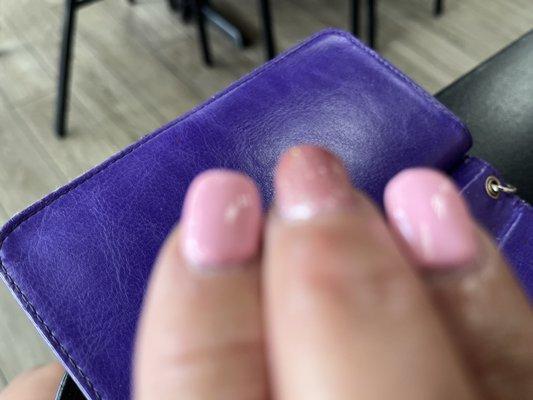 Showing how thick the nails look at how far away they are from the cuticle