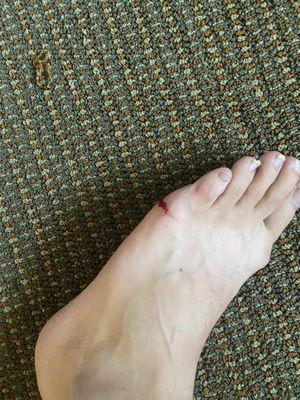 My bleeding foot from a fragment of glass