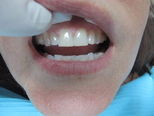 Cosmetic Dentistry