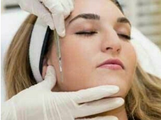 Dermaplaning