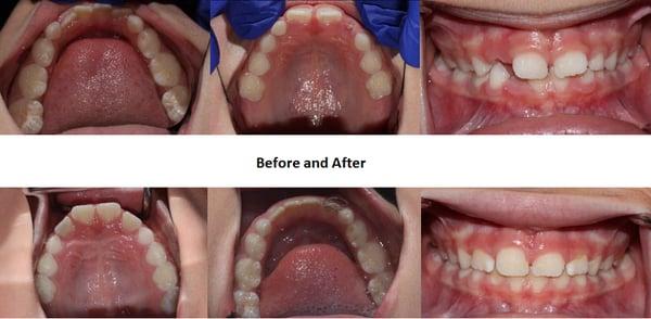 Healthy Start Before and After