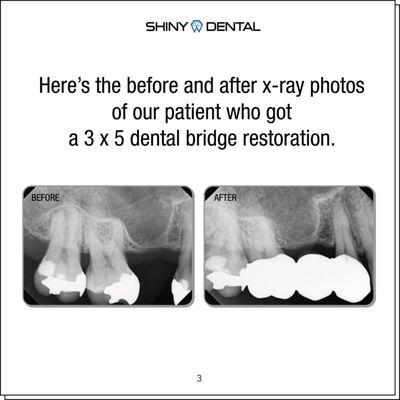 Shiny Dental Cosmetic, Family Dentistry & Dental Implants | Call: (832) 930-7778 | 12757 Westheimer Rd  Houston, TX 77077