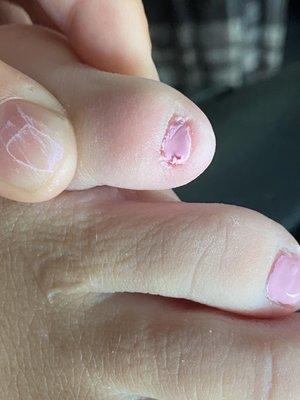 my friends toes (this is immediately after and she didn't hit it)