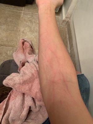 He was so filthy I had to bathe him as soon as he got home. He was so scared this was my arm after.