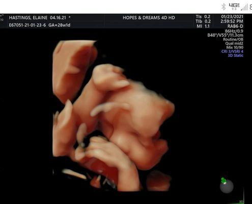 3D photo at 28 weeks