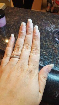 Healthy nails