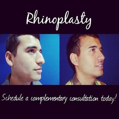 Rhinoplasty/Nosejob