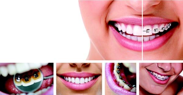 Smile Dental Care Clinic