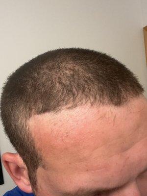 This hands down is the very worst haircut I ever got in my life. This is absolutely horrible.