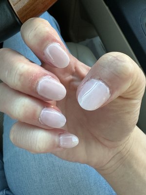 Cuticles done horribly