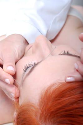 facial acupuncture - gentle, effective, natural, can take 10 years off the face!