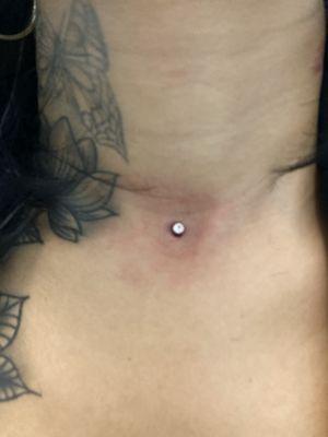 Dermal