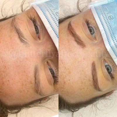 Befor Vs After Microblading