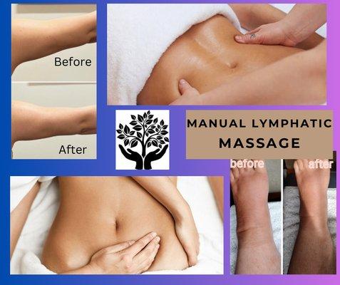 Manual Lymphatic Drainage Massage 
Traditional & Post Surgery Massage