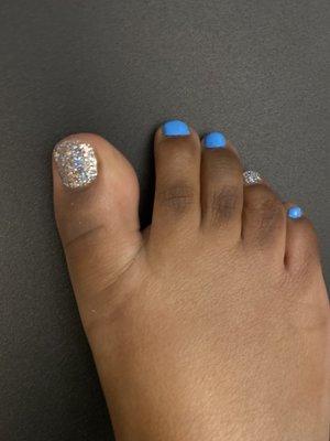 Gel toes